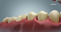 【牙齿模型】全副写实3dsmax模型