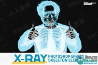 透明骨架X-射线元素医疗影像效果PSD模板