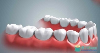 【牙齿模型】全副写实3dsmax模型
