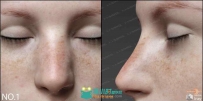 雀斑脸颊多组不同形态鼻子3D模型